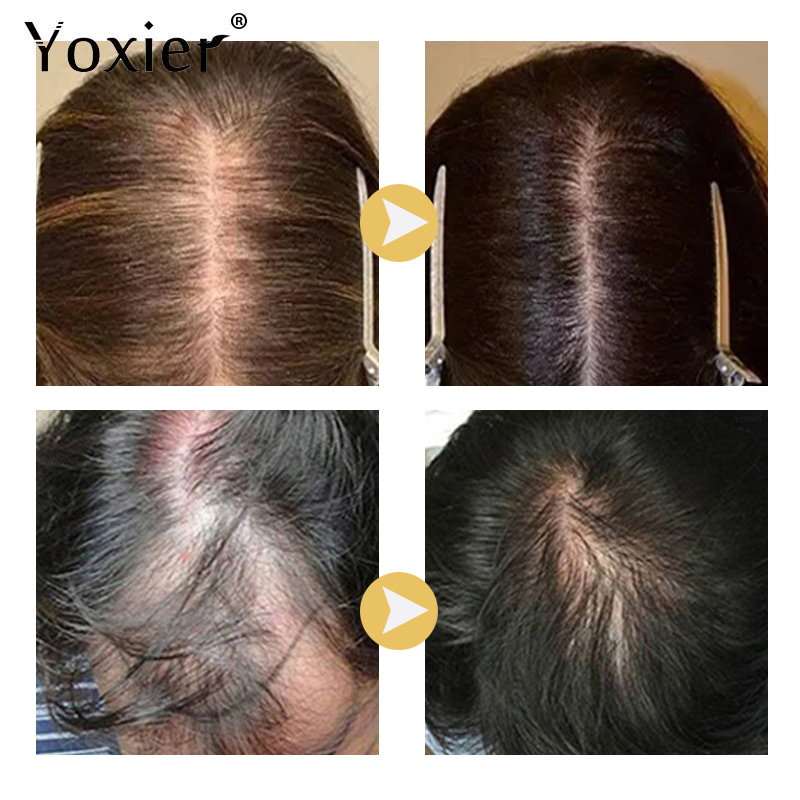 Chuyên Sâu Serum Kích Kem Ngăn - đánh giá và giá Hair Care Treatment